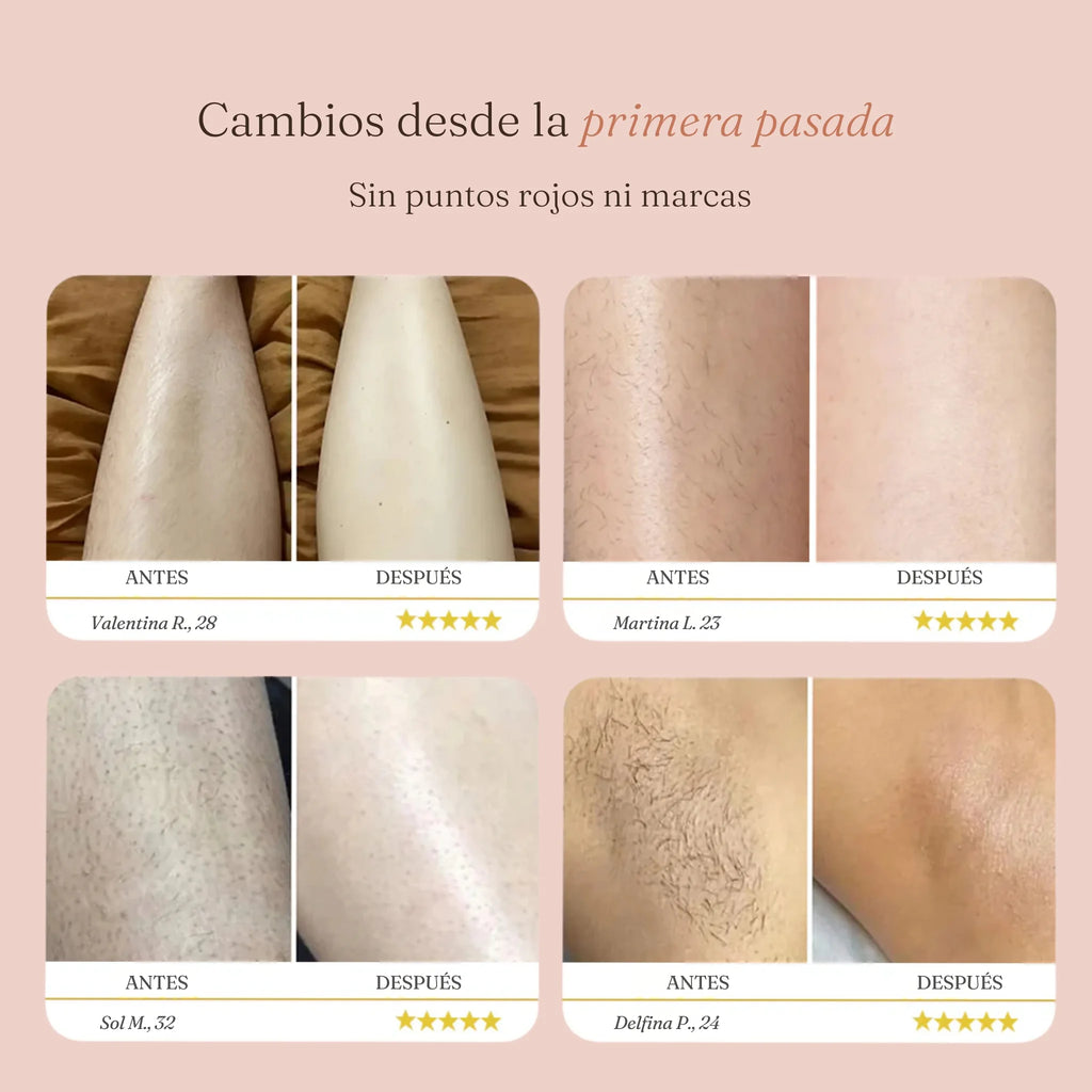 Depiladora DOBLE Cabezal |  ANNURI™